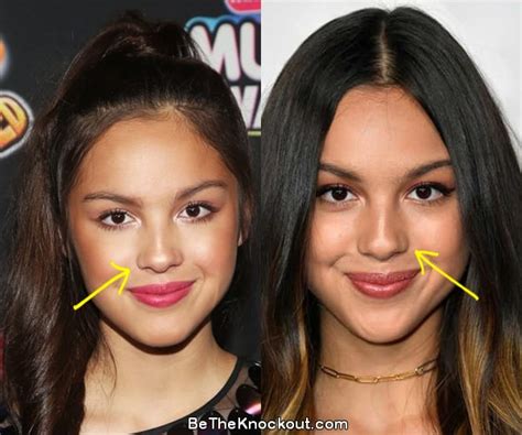 does olivia rodrigo have implants|19 Stars Who Have Opened Up About Getting Plastic。